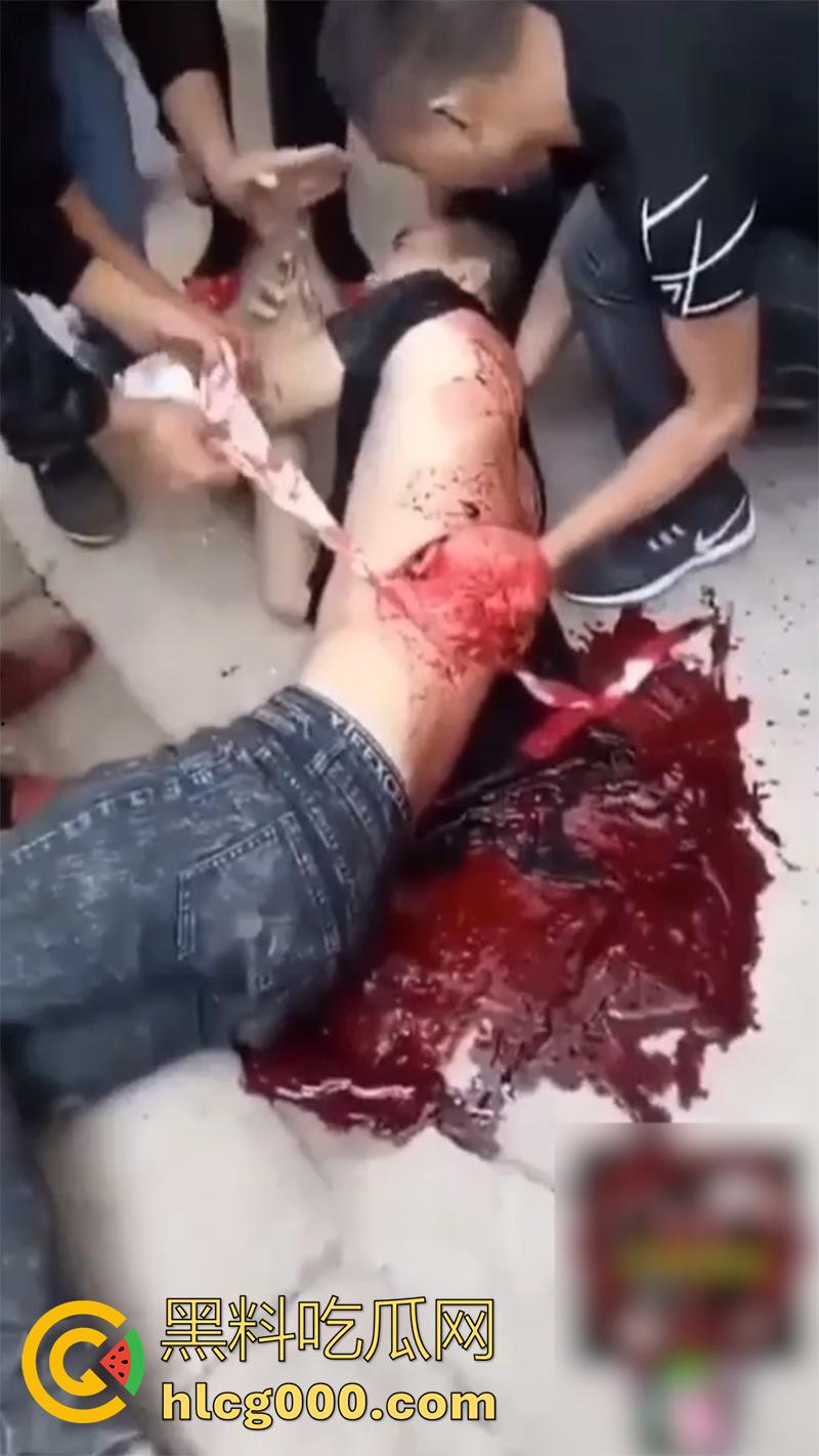 暗网流出恐怖一幕合集，小伙被砍透背部，东南亚混战分尸现场，树林剁头女孩被霸凌跳楼，胆小者勿入啊！