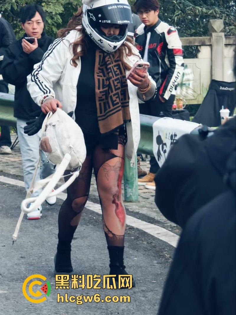 美图秀秀弱爆了 这才是真实磨皮!胖妹装逼压弯失控撞车 黑丝当场爆裂惨遭磨皮 大腿血肉模糊 真是悲惨又丢人!