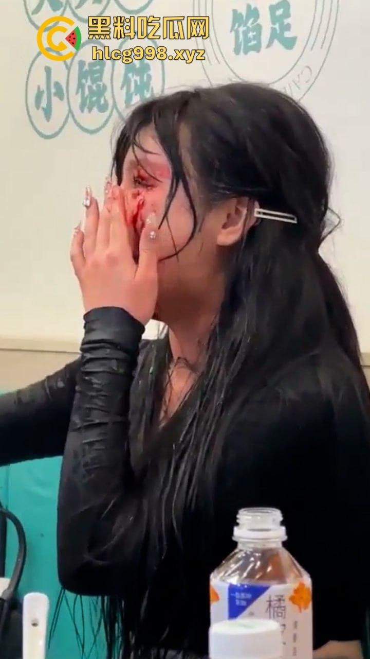 上海俩美女饭店打架下手忒狠 全然不知走光被偷拍 黑衣服这是奶子是真的吗?