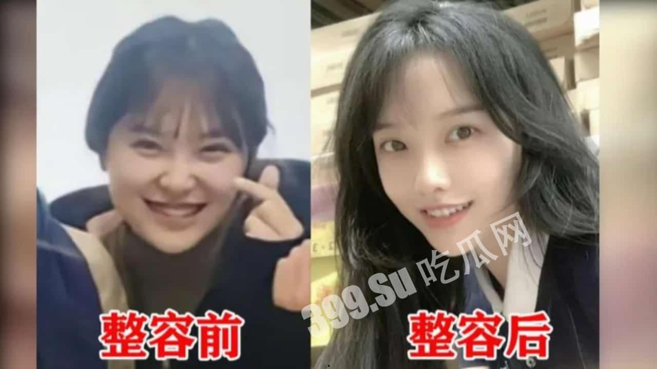 「挖呀挖老师」甜美笑眼全靠滤镜? 前同事爆料整容前照片 爆红后「从身分→颜质」遭全方位抹黑 直播中不禁落泪