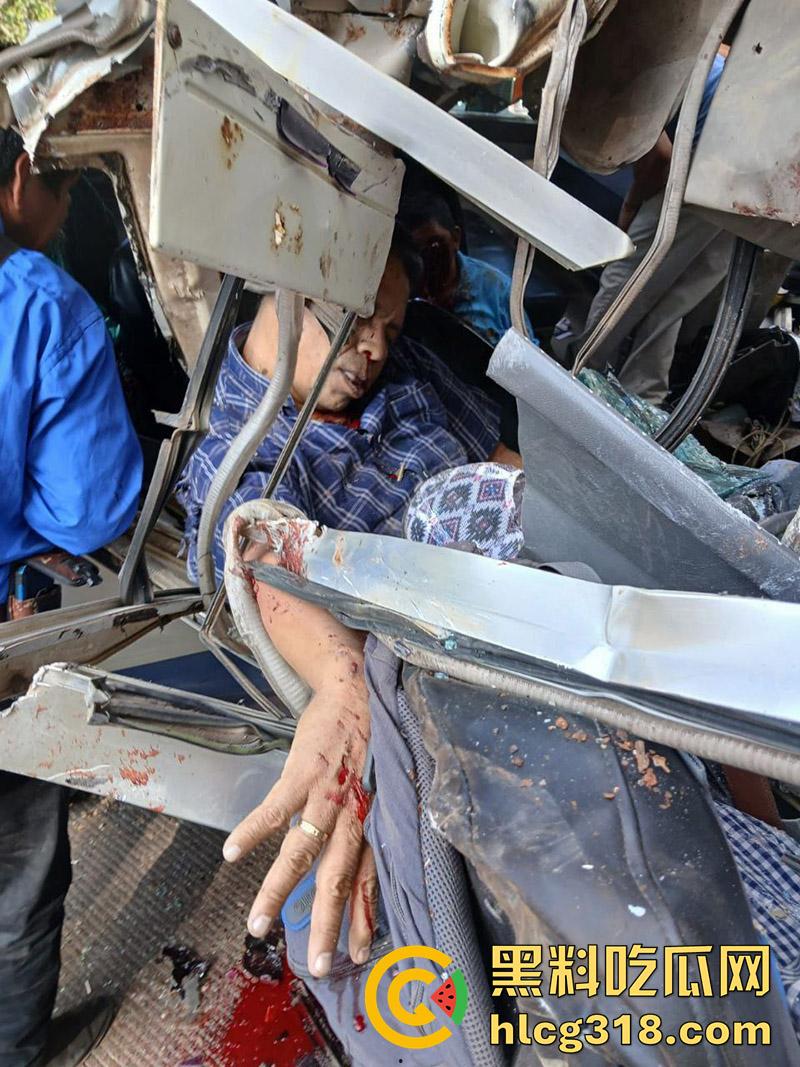 车祸没死脸却没了!印尼发生惨烈车祸,超速行驶失控撞上货车,乘客全部死亡司机面目全非!