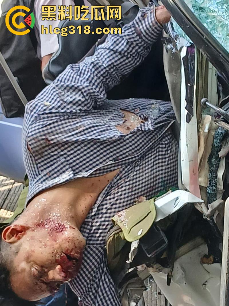 车祸没死脸却没了!印尼发生惨烈车祸,超速行驶失控撞上货车,乘客全部死亡司机面目全非!