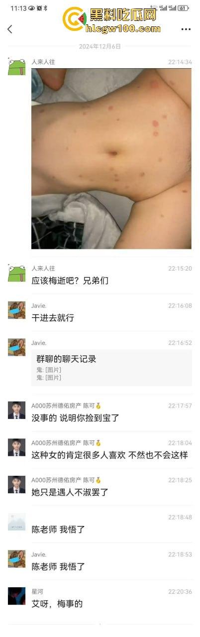 河南信阳啤酒森林酒吧惊现病毒母体!毒王身体浑身溃烂吓退众人,最近国内真的特别多各位瓜友一定要注意。