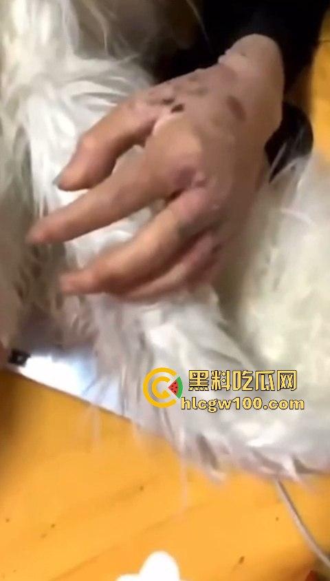 河南信阳啤酒森林酒吧惊现病毒母体!毒王身体浑身溃烂吓退众人,最近国内真的特别多各位瓜友一定要注意。