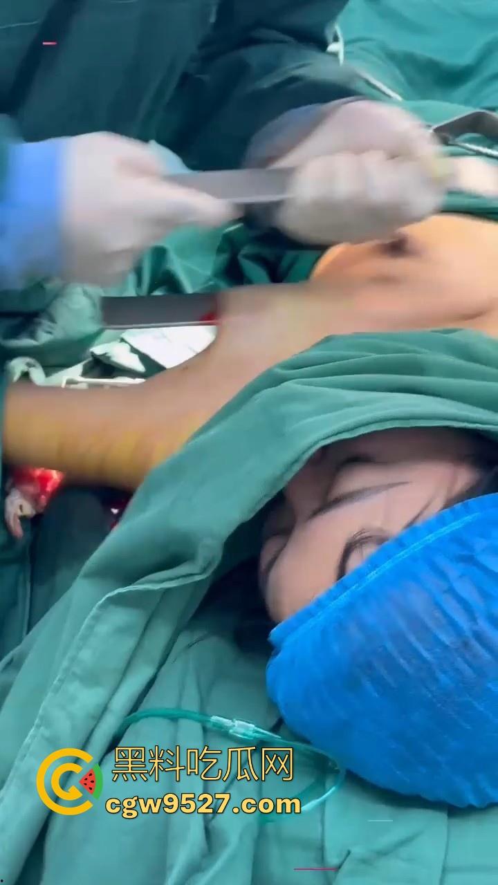 隆胸整形手术现场大曝光！平乳妹秒变巨乳御姐，手术过程一览无遗，女人为变美的代价真大！