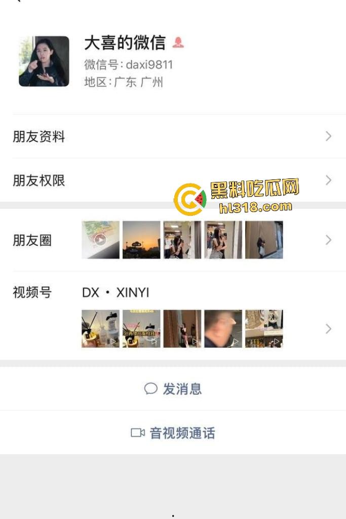 抖音【DA喜儿】高颜女神表面医美买衣,实则卖逼拍自慰视频,用金主送的避孕套塞逼里搅和!