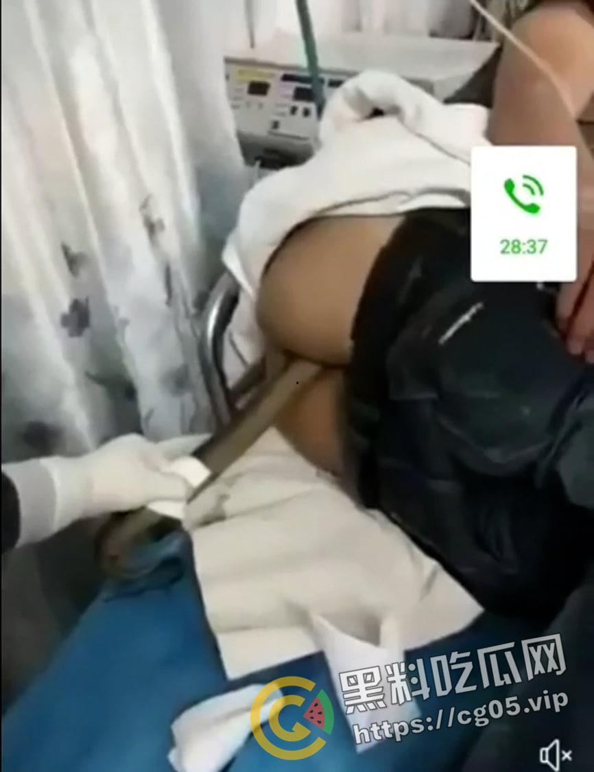 黄鳝入肛 一去不回 整活把自己整进医院了 医生扯出来半米长的黄鳝惊呆了