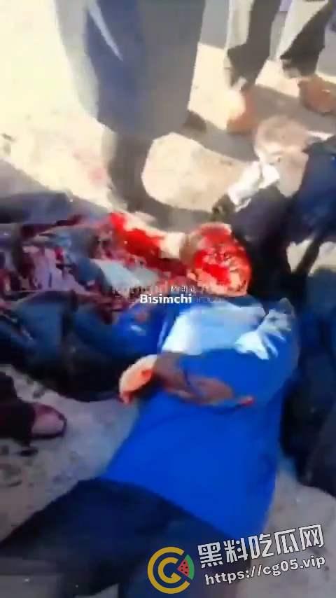 伊朗纪念已故将军卡西姆·苏莱马尼举办纪念仪式 现场发生两起爆炸 死伤数百人 惨不忍睹