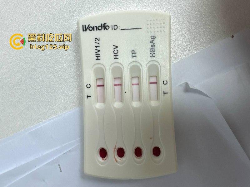 可怕!为了报复社会把带血针头扎进了共享单车的座椅里……山东商业技师学校20个被感染艾滋!!!