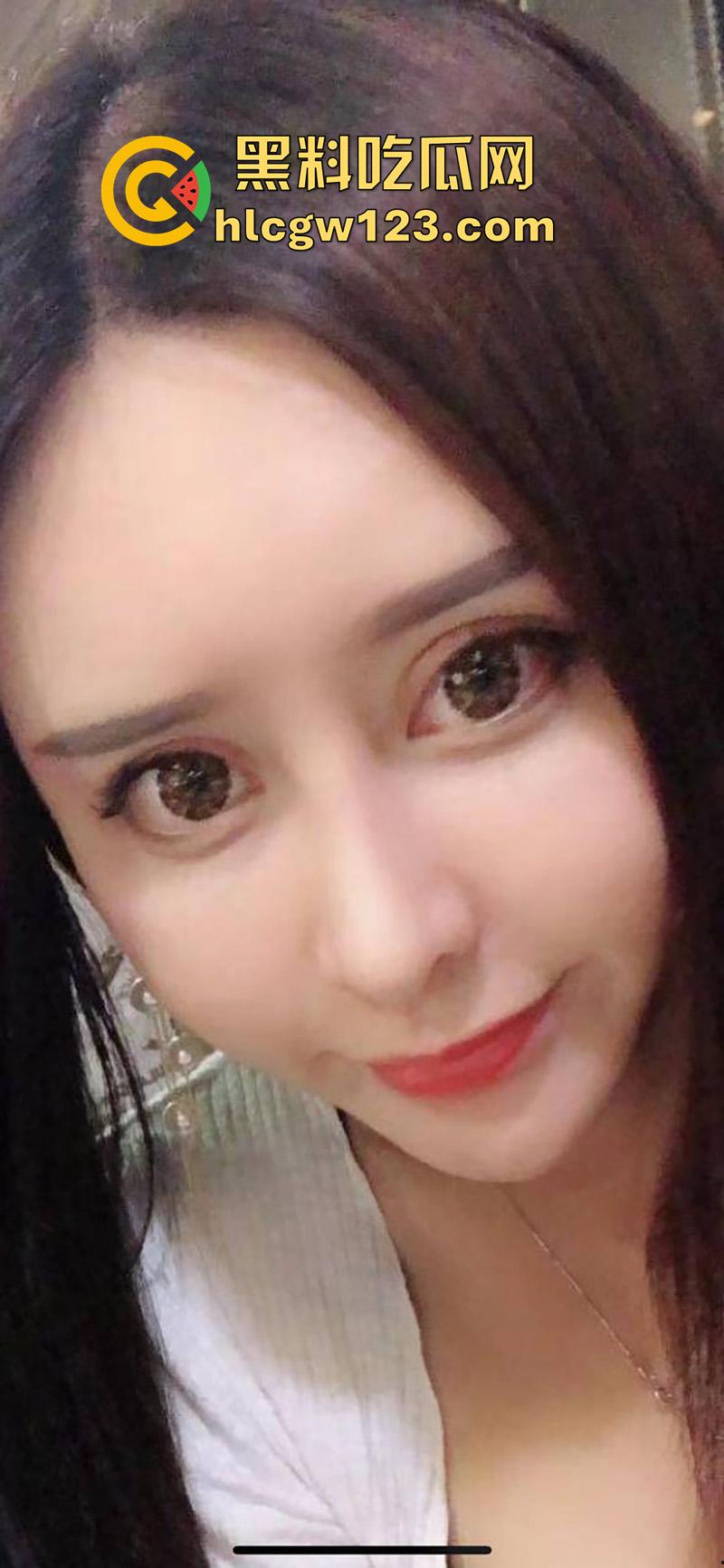 成都整容女生化母体,颜值高身材高挑性感,经常卖逼约炮染上梅毒,到处约炮感染年轻帅哥!