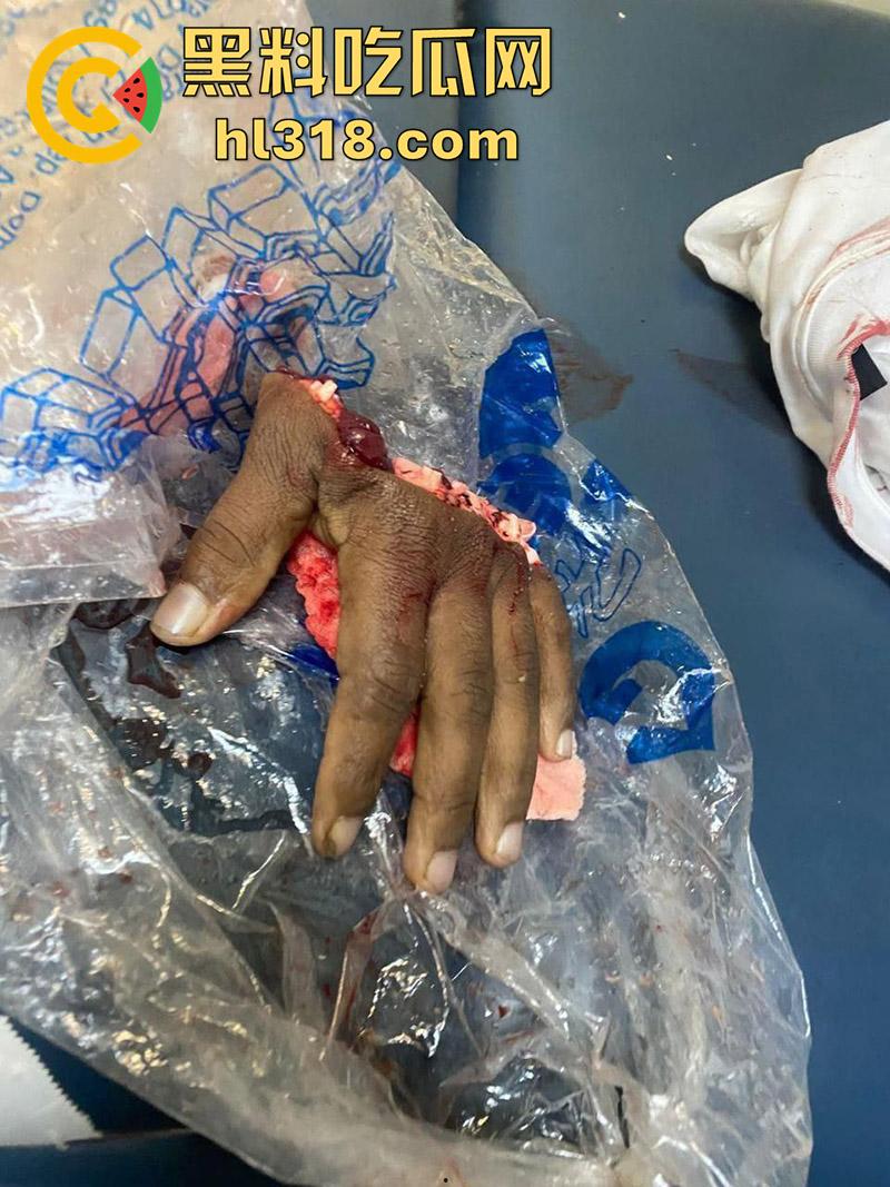 美国夜晚的恐怖,两拨黑哥发生冲突,老黑一刀将对方手掌切断,这刀是真快啊,这回估计要赔钱啦!