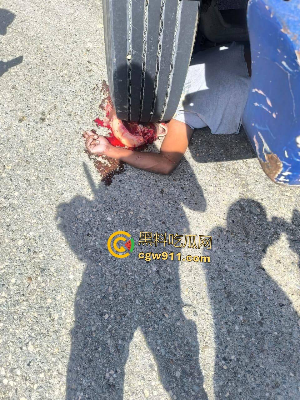 印尼摩托狂飙遭碾压！脑袋头皮刮飞露白骨，摩托吱吱狂响，车祸现场震碎人心，这还能救活吗？