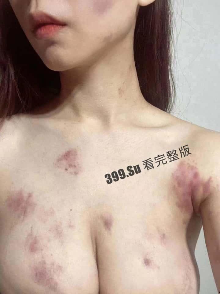 抖音百万粉丝博主 雅典娜 Liya 被闺蜜骗去菲律宾卖进妓院!惨遭毒打、强奸 奶子都被打得青一片紫一片