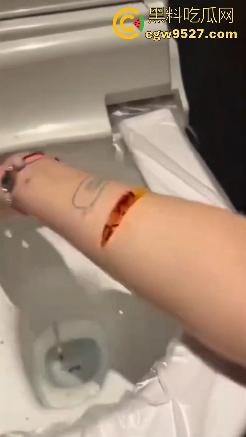 全网疯传马桶割腕女孩,真实自杀鸡皮疙瘩都起来了,脂肪层都割开了,还扒拉了一下,太重口了!