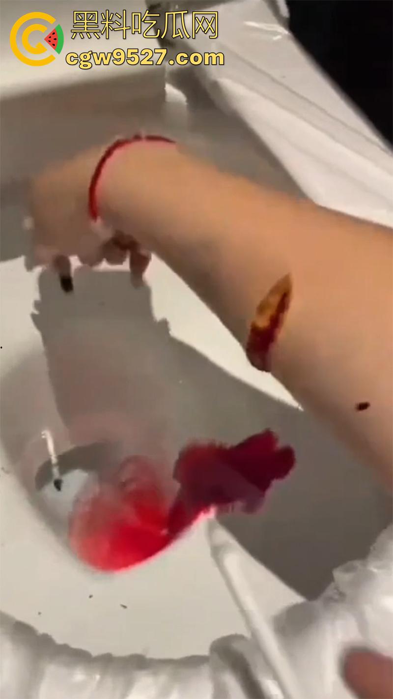 全网疯传马桶割腕女孩,真实自杀鸡皮疙瘩都起来了,脂肪层都割开了,还扒拉了一下,太重口了!