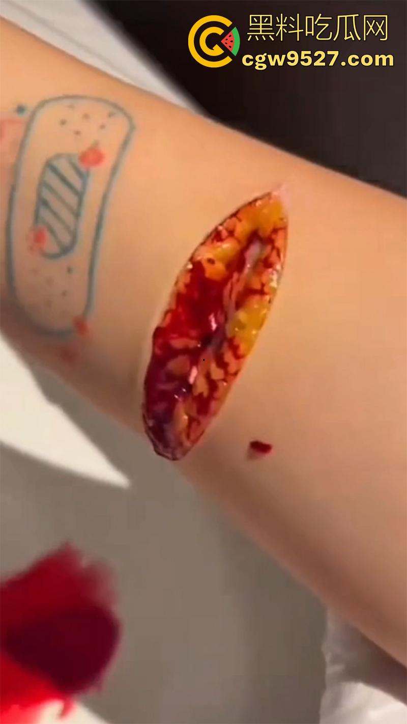 全网疯传马桶割腕女孩,真实自杀鸡皮疙瘩都起来了,脂肪层都割开了,还扒拉了一下,太重口了!