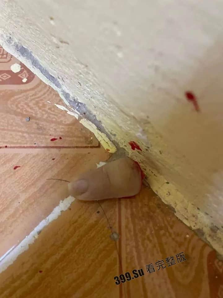 中国女孩王某被人诱骗到柬埔寨 后遭越南人绑架 被切掉一根 手指,并拍摄下视频威胁其国内家人勒索500万