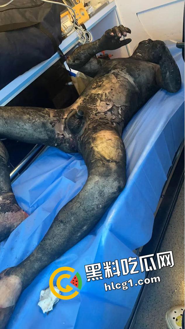 江西宜春江大桥电车着火 驾驶员鸡巴都被烧掉了 浑身烧焦 现场惊悚画面流出