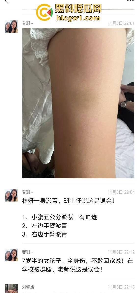 广州金隆小学曝惊天丑闻!初中学生遭体罚虐待,遍体鳞伤,家长被辱骂怒火中烧!