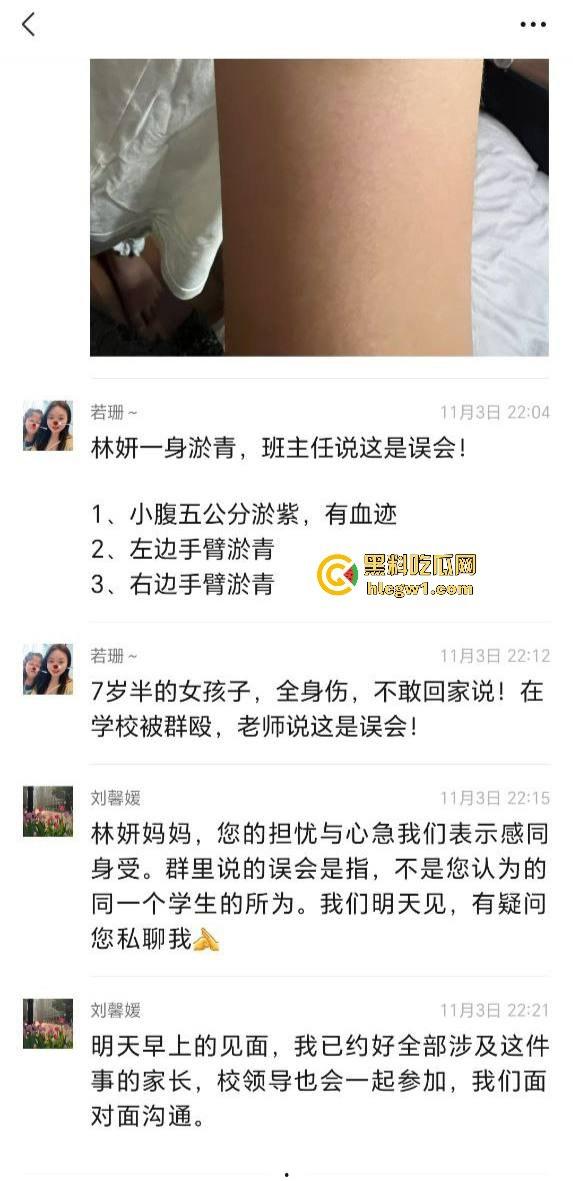 广州金隆小学曝惊天丑闻!初中学生遭体罚虐待,遍体鳞伤,家长被辱骂怒火中烧!