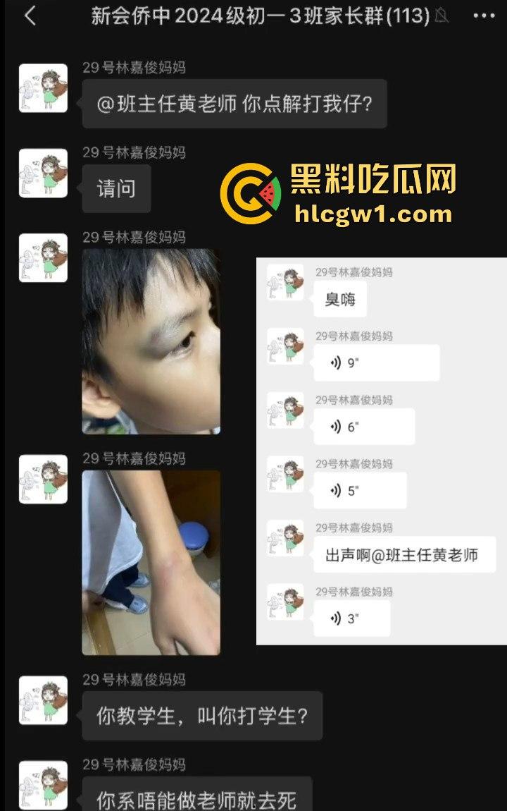广州金隆小学曝惊天丑闻!初中学生遭体罚虐待,遍体鳞伤,家长被辱骂怒火中烧!