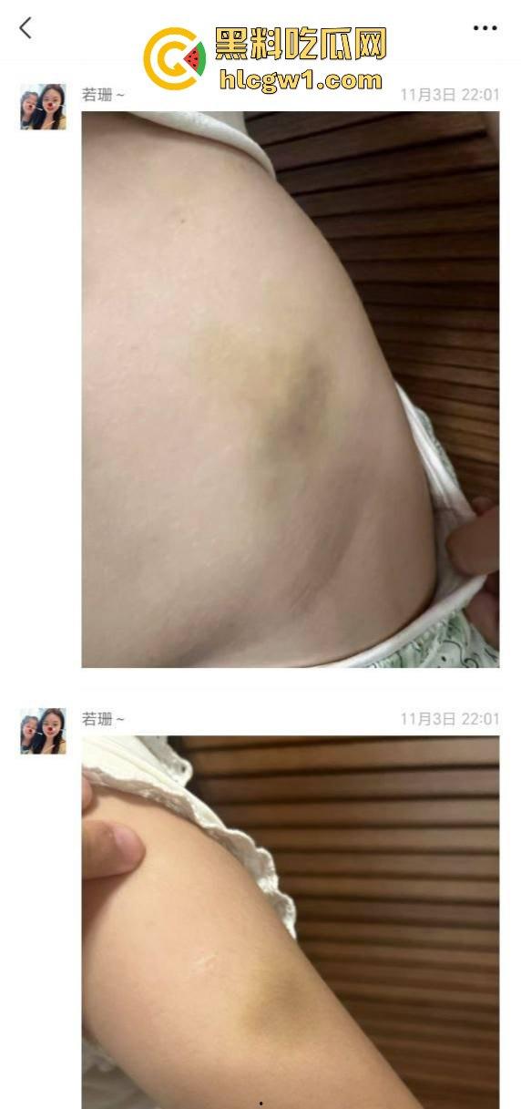 广州金隆小学曝惊天丑闻!初中学生遭体罚虐待,遍体鳞伤,家长被辱骂怒火中烧!